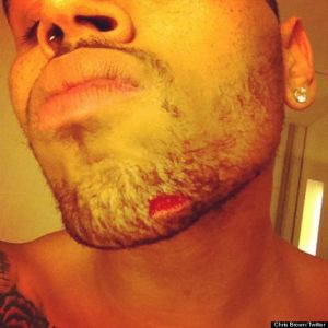 Chris Brown Fight with Drake Cut on Chin Criminal Battery: Rihannas Ex, Chris Brown, Injured In Bar Fight with Drakes Entourage